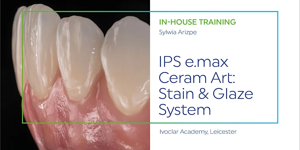 IPS e.max Ceram Art: Stain & Glaze System