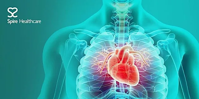 Your questions answered – free heart health Q&A evening at Spire Cardiff Hospital