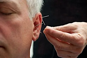 Lunchtime Reset: Community Ear Acupuncture at 4 Barnfield Cres
