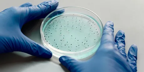 How Parasites Have Shaped Us