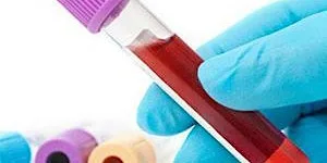 Phlebotomy (Venepuncture) Training - In Person - NEWCASTLE (ACCREDITED)