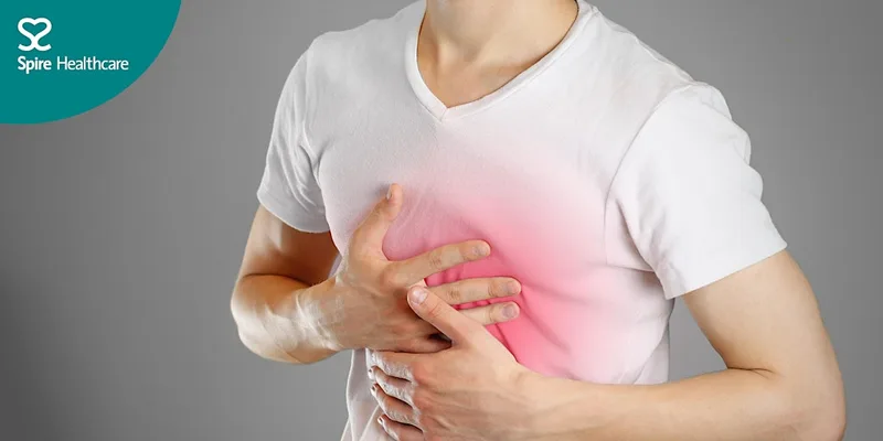 Ask an expert: upper gastrointestinal Q&A evening